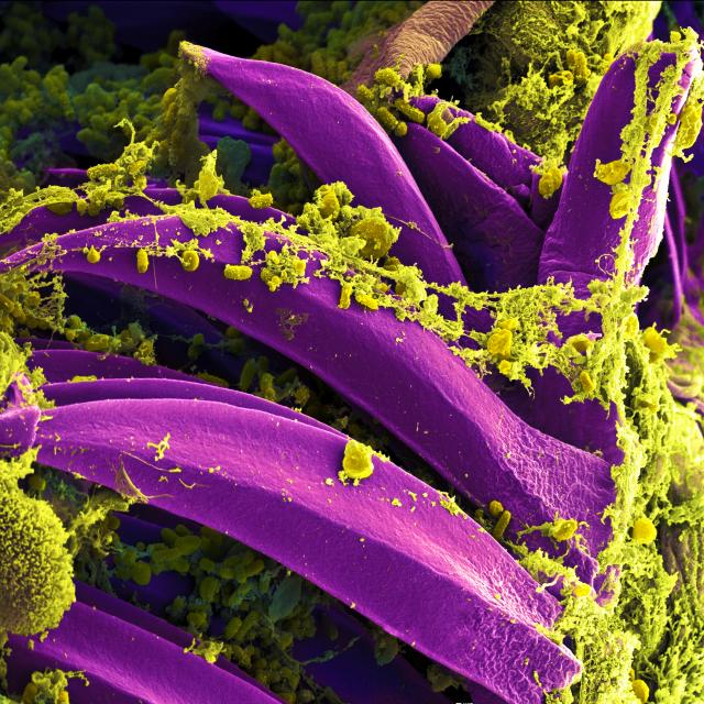 Scanning electron micrograph of Yersinia pestis bacteria on proventricular spines of a Xenopsylla cheopis flea